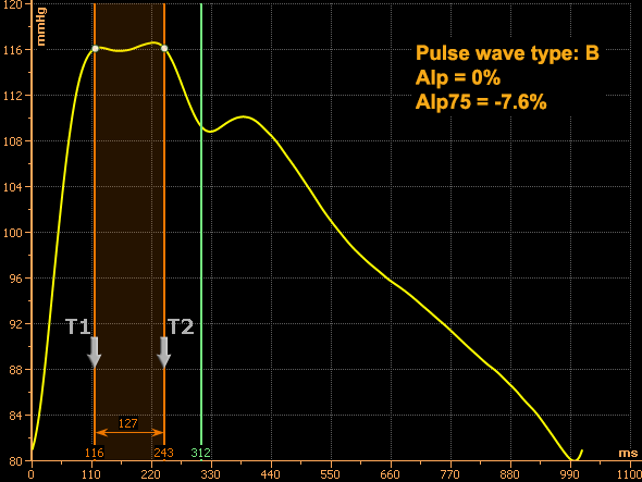 Type B pulse wave