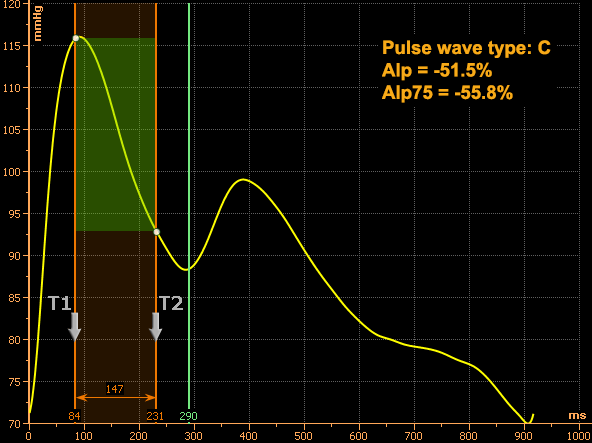 Type C pulse wave