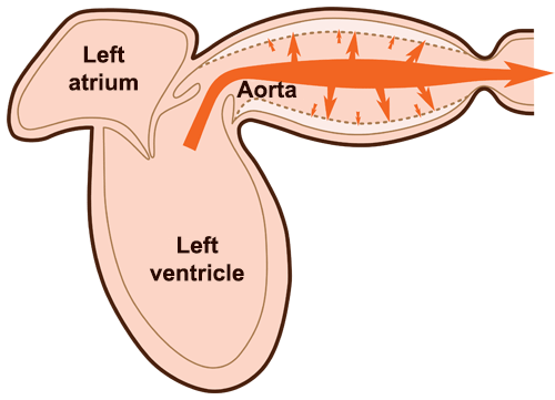 Pulse wave generation for normal aorta elasticity.
