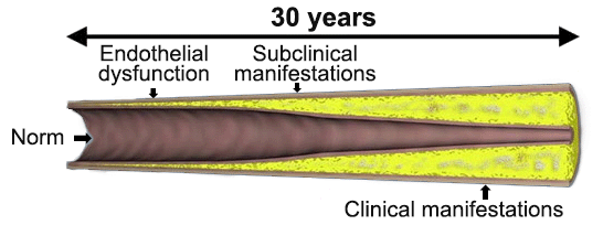 Development of atherosclerotic lesions of the arteries