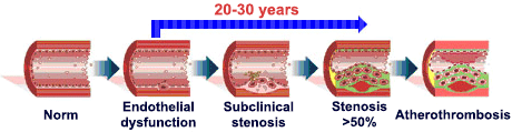 over-time deterioration of the arterial condition